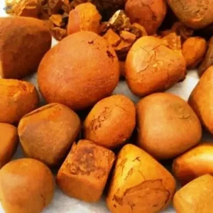 OX Gallstones